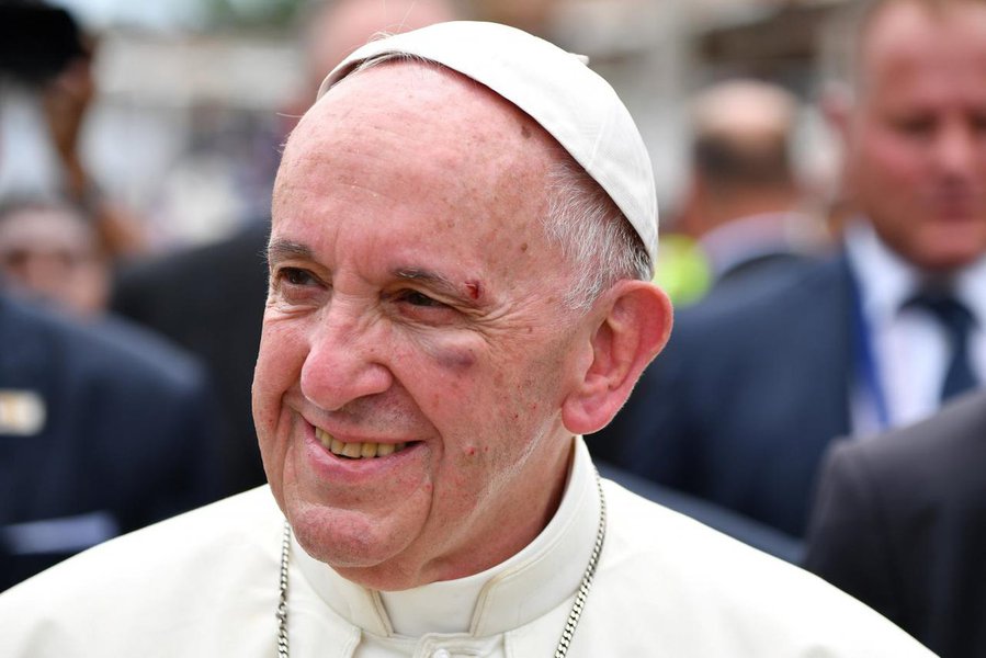Papa Francisco machuca o rosto na última etapa de viagem à Colômbia