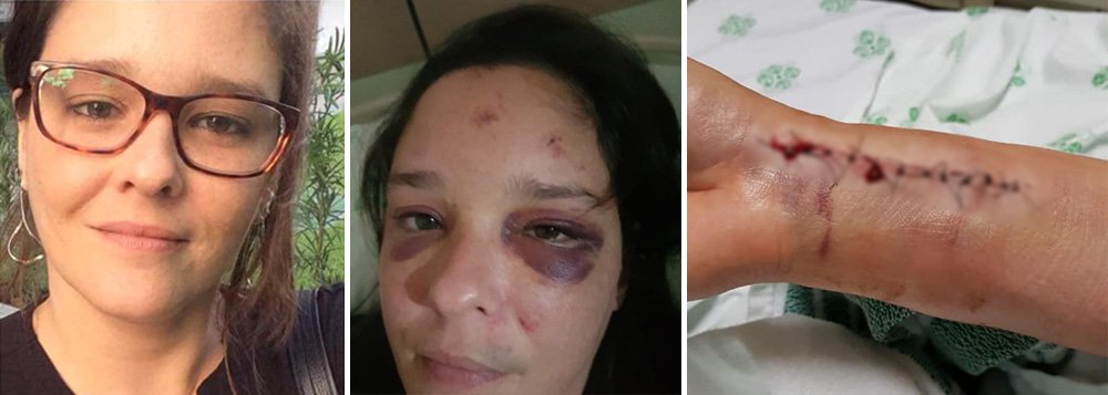 Mais uma mulher é agredida por Bolsonaristas em Pernambuco