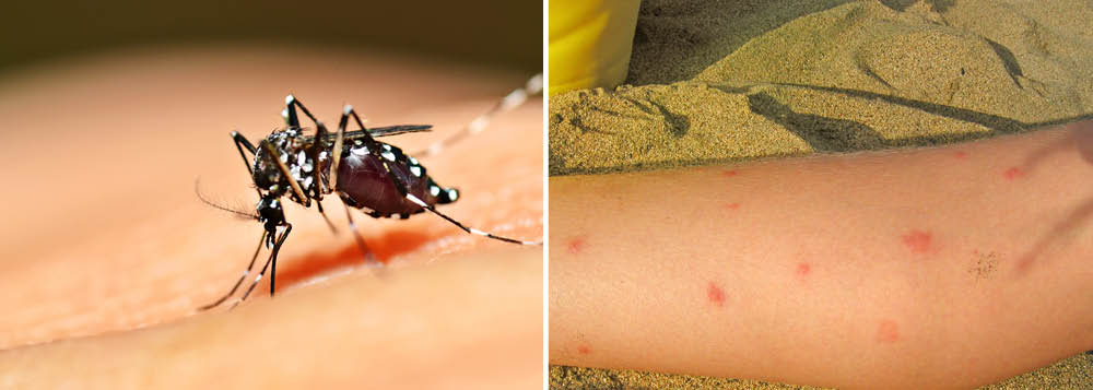 Surto de dengue já matou 50 pessoas em Minas