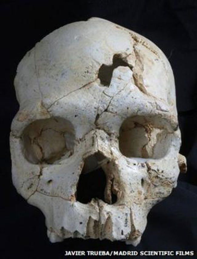 Crânio de 460 mil anos com ferimento na fronte