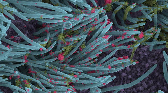 Coronavírus atacam células ciliares do pulmão
