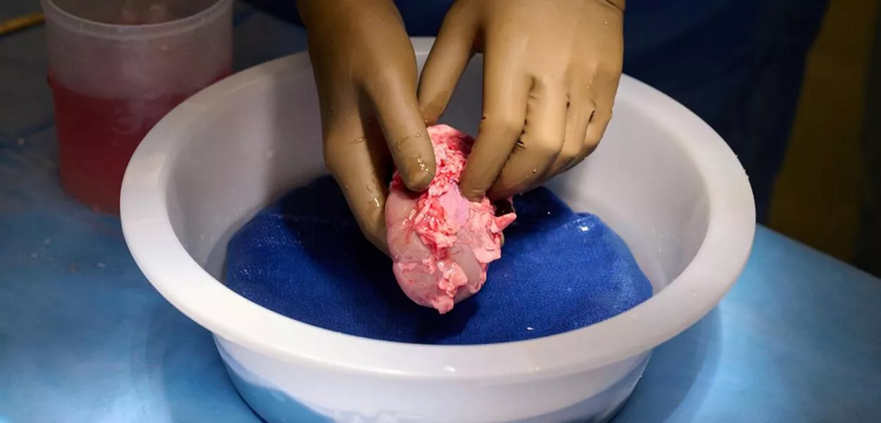 Cirurgiões dos EUA testam transplante de rim de porco em humano