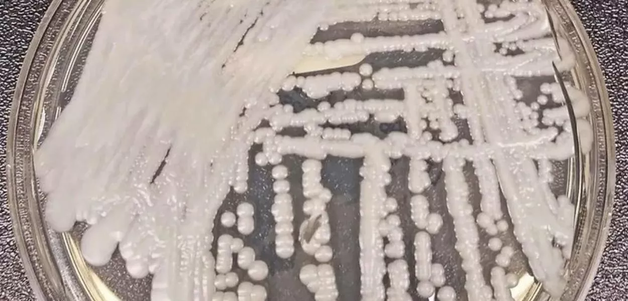 Fungo Candida auris