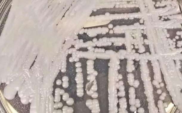 Fungo Candida auris