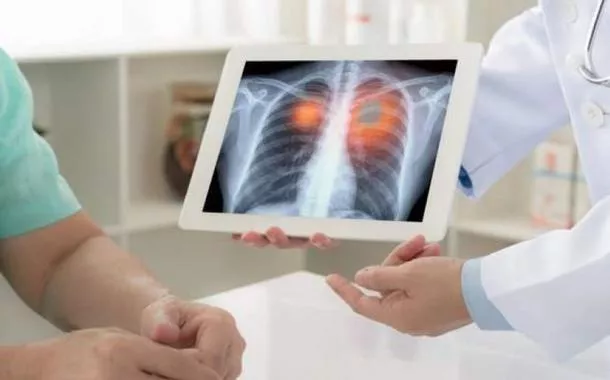 Fiocruz: casos de síndrome respiratória aguda grave aumentam no Brasil no país