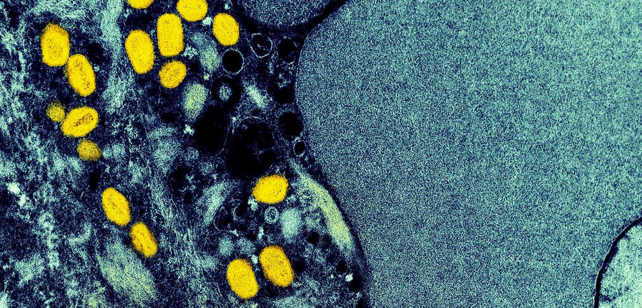 Micrografia eletrônica partículas de varíola de macaco