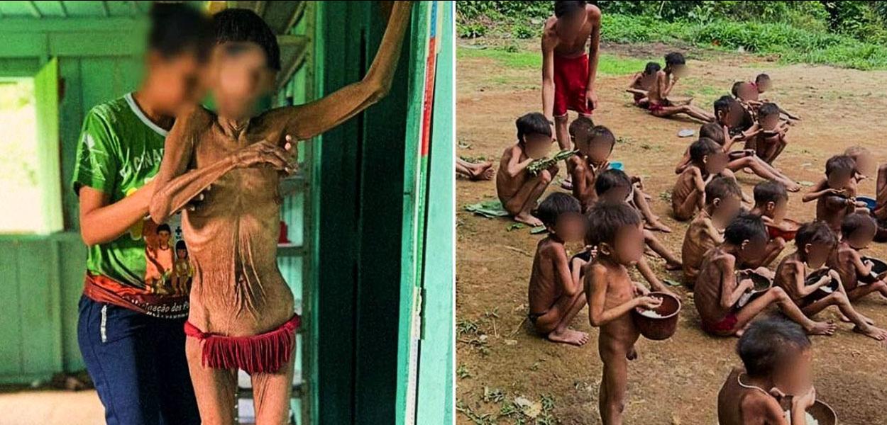 Terra Indígena Yanomami sofre com malária, contaminação por mercúrio e desnutrição severa