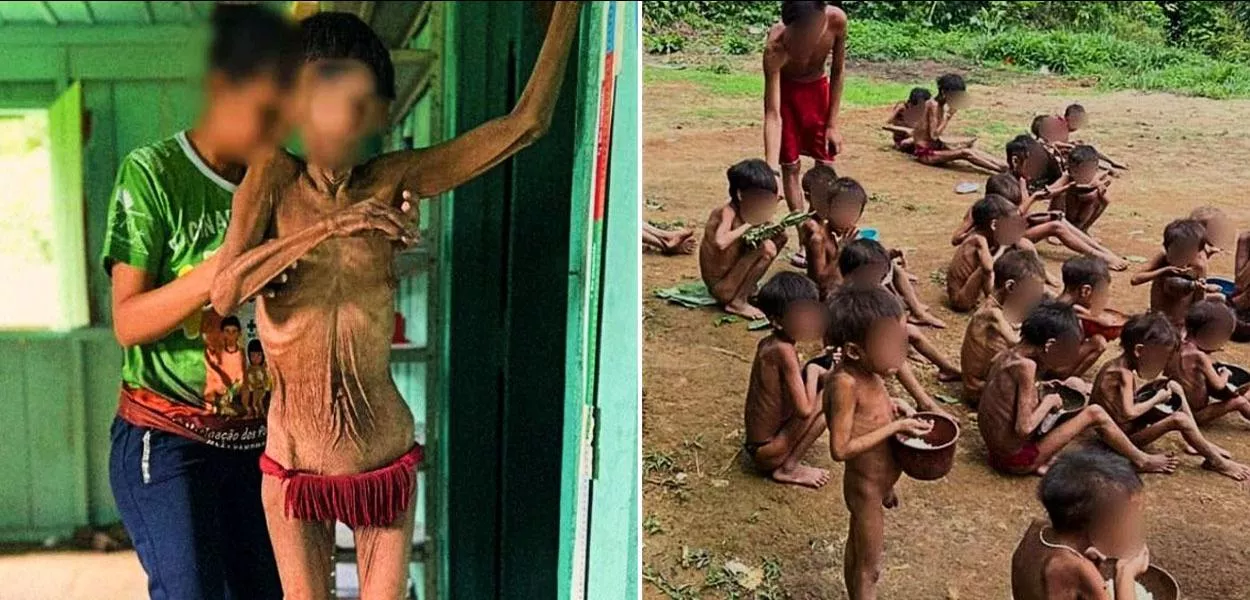 Invadida por garimpeiros e abandonada pelo governo Bolsonaro, Terra Indígena Yanomami sofre com malária, contaminação por mercúrio e desnutrição severa
