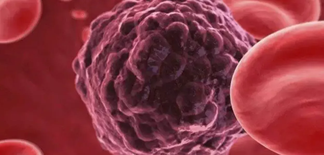 Brasileiros investigam como terapias celulares podem ajudar a tratar leucemia