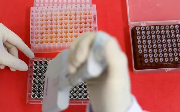 Funcionário trabalha em teste para detecção de anticorpos do vírus da gripe aviária