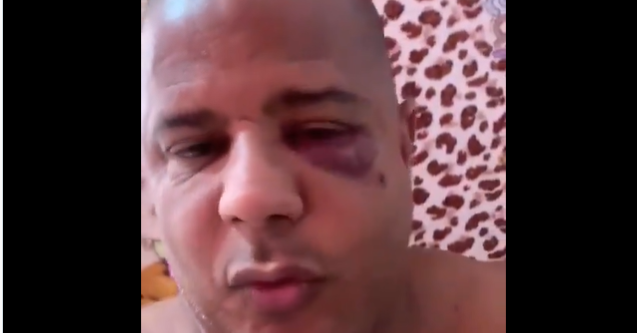 Marcelinho Carioca reaparece com sinais de tortura e diz que foi sequestrado por marido de amante (vídeo)