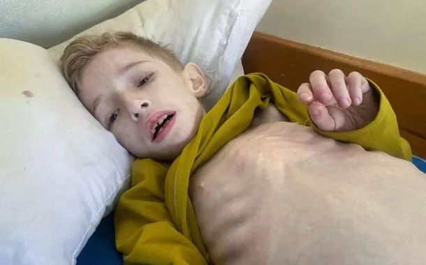 Em Gaza, crianças famintas lotam enfermarias de hospitais