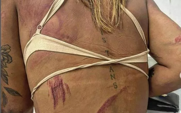 Trans, assessora de vereadora de Niterói é agredida em bar no Rio