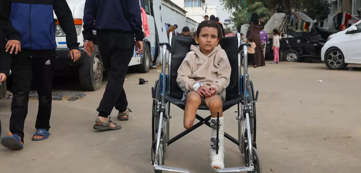 Menina palestina que teve membro amputado após ser ferida em ataque israelense