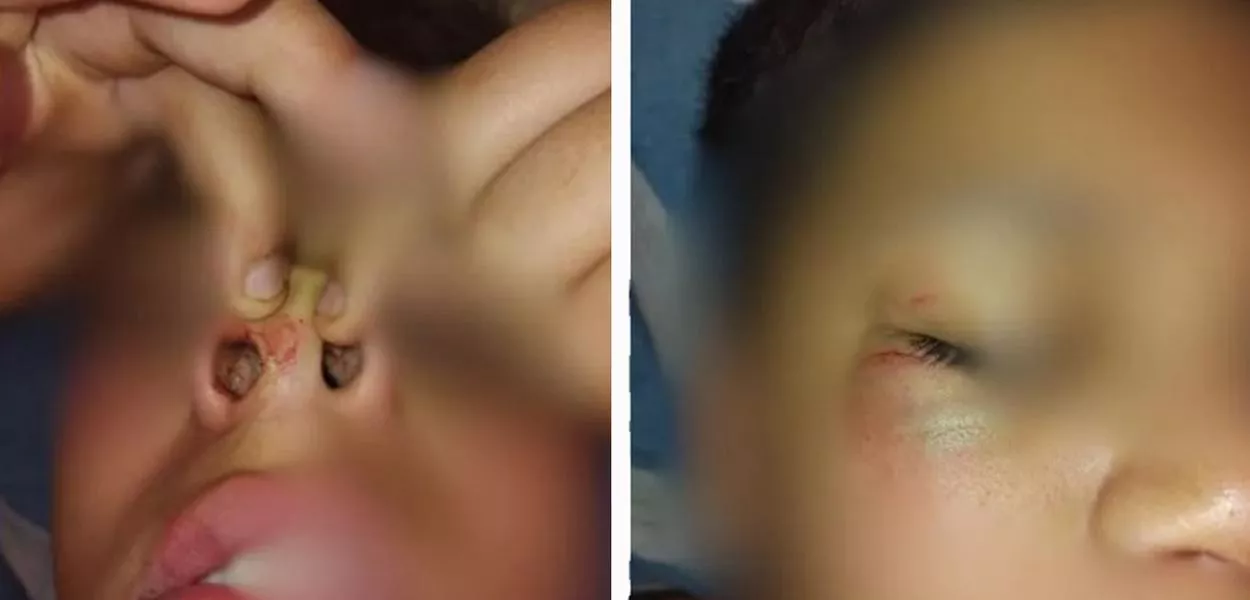 Menino de 12 anos