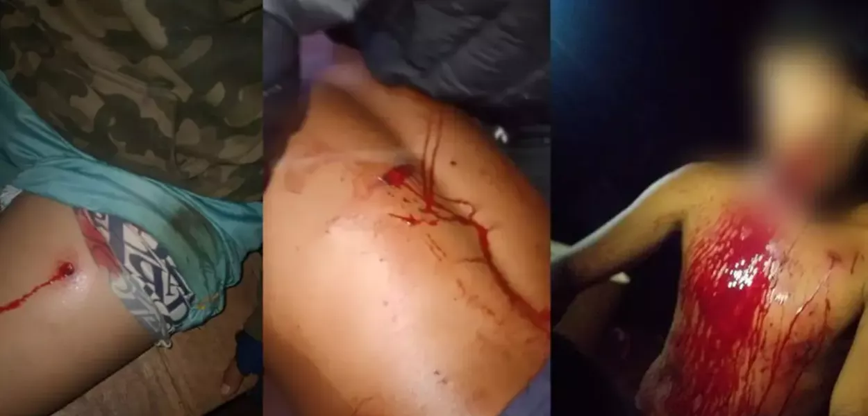 Na noite de sexta-feira (3), quatro indígenas da comunidade Yvy Okaju (antigo Y’Hovy), do povo Avá-Guarani, foram feridos a tiros
