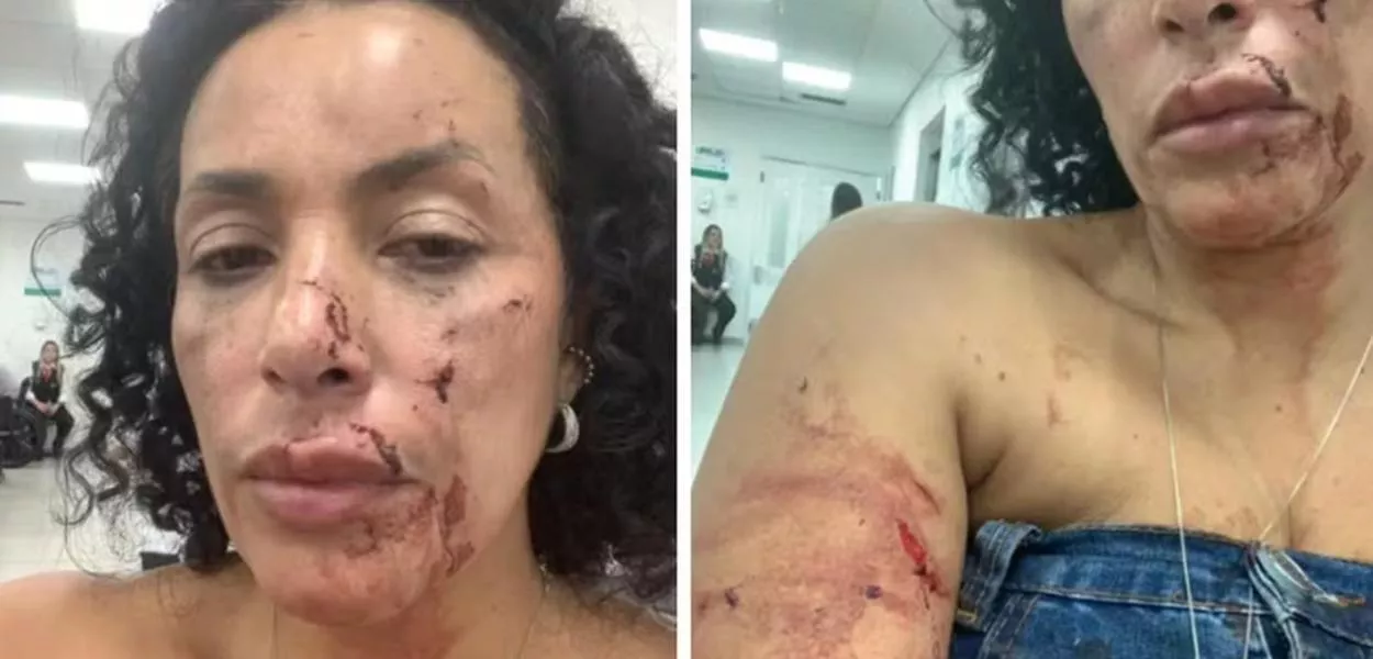 Mulher acusa dono de bar de samba em SP de agressão