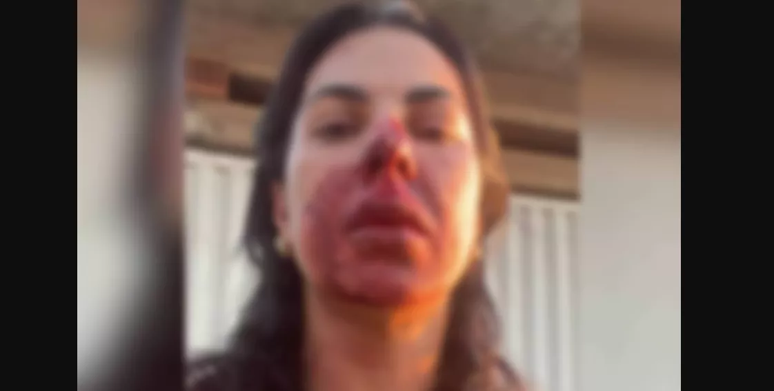Maria Sueli Sobrinho, de 48 anos, foi vítima de agressão enquanto cumpria um mandado judicial no bairro Novo Horizonte, em Ibirité