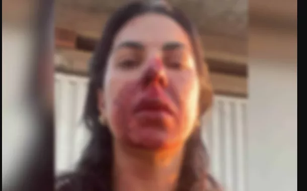 Sargento da PM é preso por agredir oficial de Justiça com socos e cabeçadas em BH