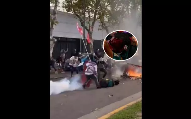 Milei continua o terror: fotógrafo é atingido na cabeça por tubo de gás lacrimogêneo e fica gravemente ferido (vídeo)