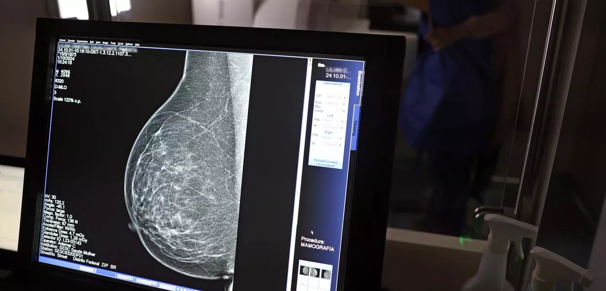 Teste de mamografia