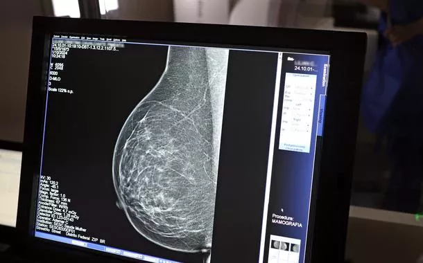 Teste de mamografia