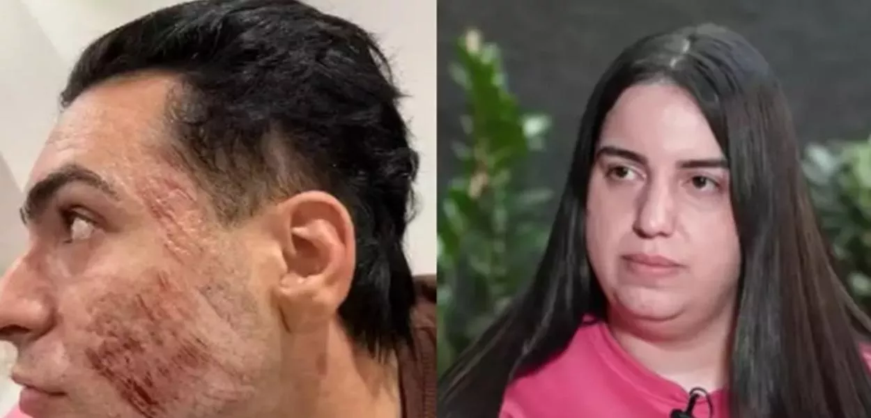 Empresário de 27 anos teve parada cardiorrespiratória após inalar substância durante procedimento estético feito por influenciadora sem formação médica