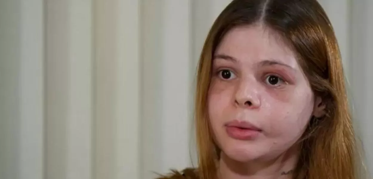 Samira Khouri foi agredida pelo ex-namorado Pedro Camilo Garcia