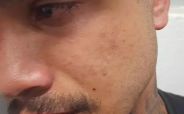 Jovem negro leva mata-leão de segurança da CPTM após pular catraca e perde dente em abordagem