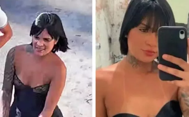 Vítima passou por cirurgias e teve as pernas amputadas devido à extensão das lesões. Agressor foi identificado como Douglas Alves da Silva, de 26 anos