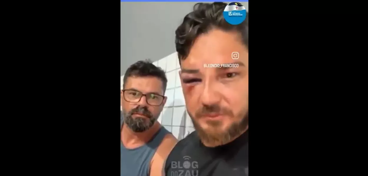 Casal agredido na praia de Porto de Galinhas (PE)