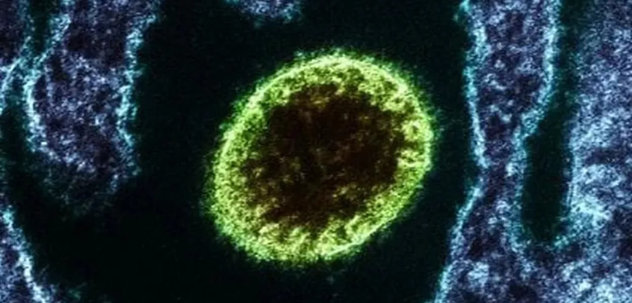 Vírus Nipah