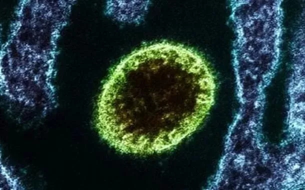 Surto do vírus Nipah na Índia acende alerta para doença com letalidade de até 75%
