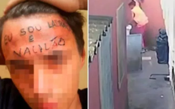 Jovem que teve testa tatuada "sou ladrão e vacilão" é preso após furto em UBS