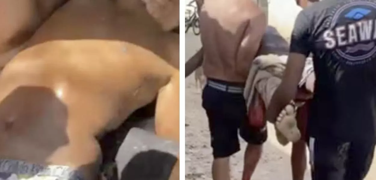 Moradores carregam adolescente mordido por tubarão no Grande Recife