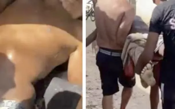 Moradores carregam adolescente mordido por tubarão no Grande Recife