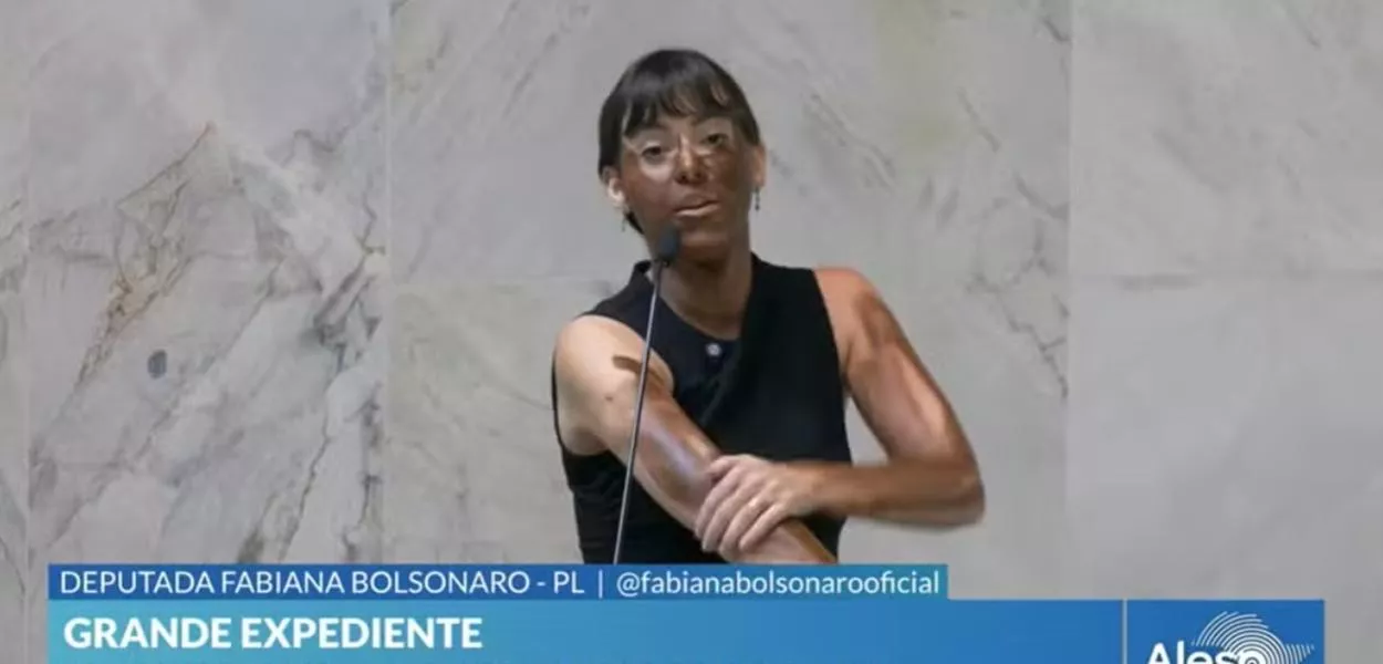 Fabiana Bolsonaro se pintou de marrom, questionando a indicação de Hilton à presidência da Comissão da Mulher na Câmara dos Deputados