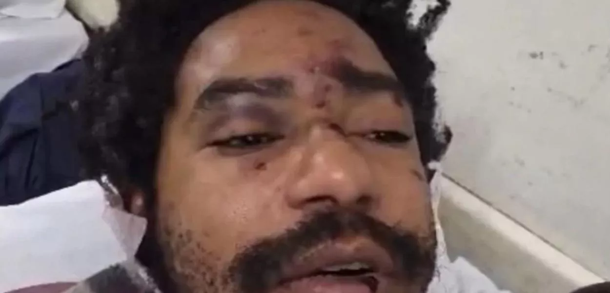 Diego Souza Moreira, ator e drag queen, teria sofrido hemorragia interna por causa das agressões