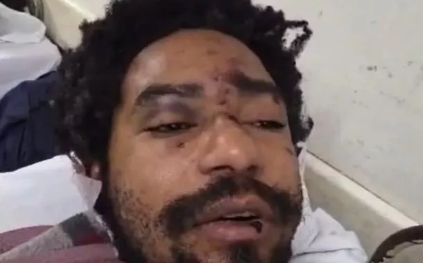 Diego Souza Moreira, ator e drag queen, teria sofrido hemorragia interna por causa das agressões