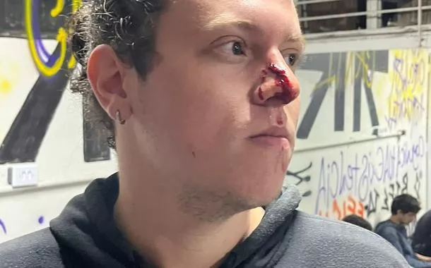 Estudante agredido pela PM durante desocupação do prédio da reitoria das USP