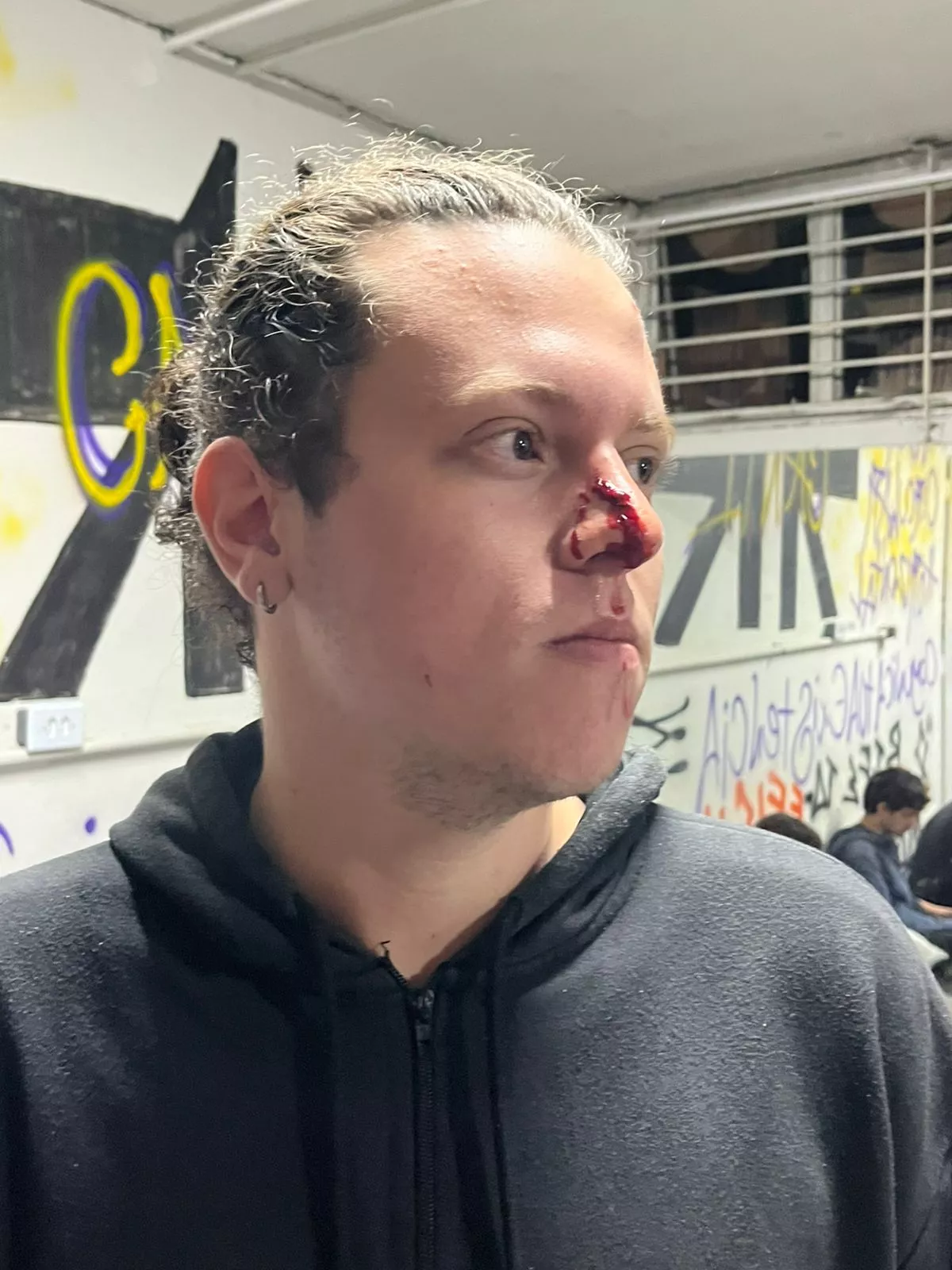 Estudante agredido pela PM durante desocupação do prédio da reitoria das USP