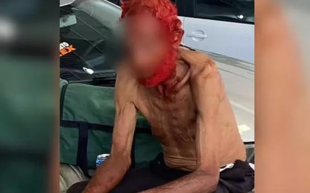 Idoso em situação de rua tem cabelos e barba tingidos de vermelho por empresário em troca de doações em Rio Preto (SP) 
