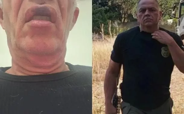 Policial aposentado é acusado de agressões contra idosos em elevador