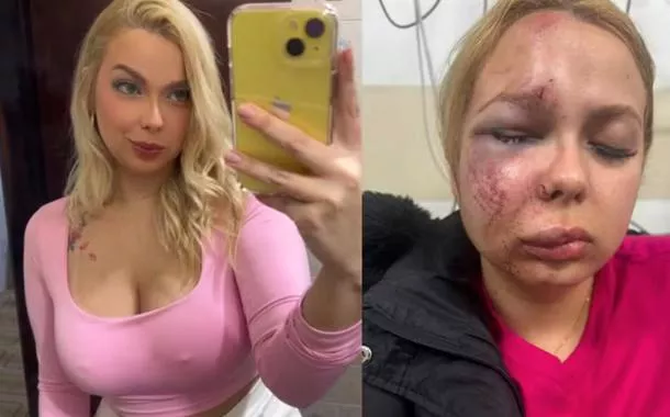 Larissa afirma que o ataque não teve motivação patrimonial e nega que se tratasse de um assalto. Para ela, a violência teve características de tentativa de feminicídio