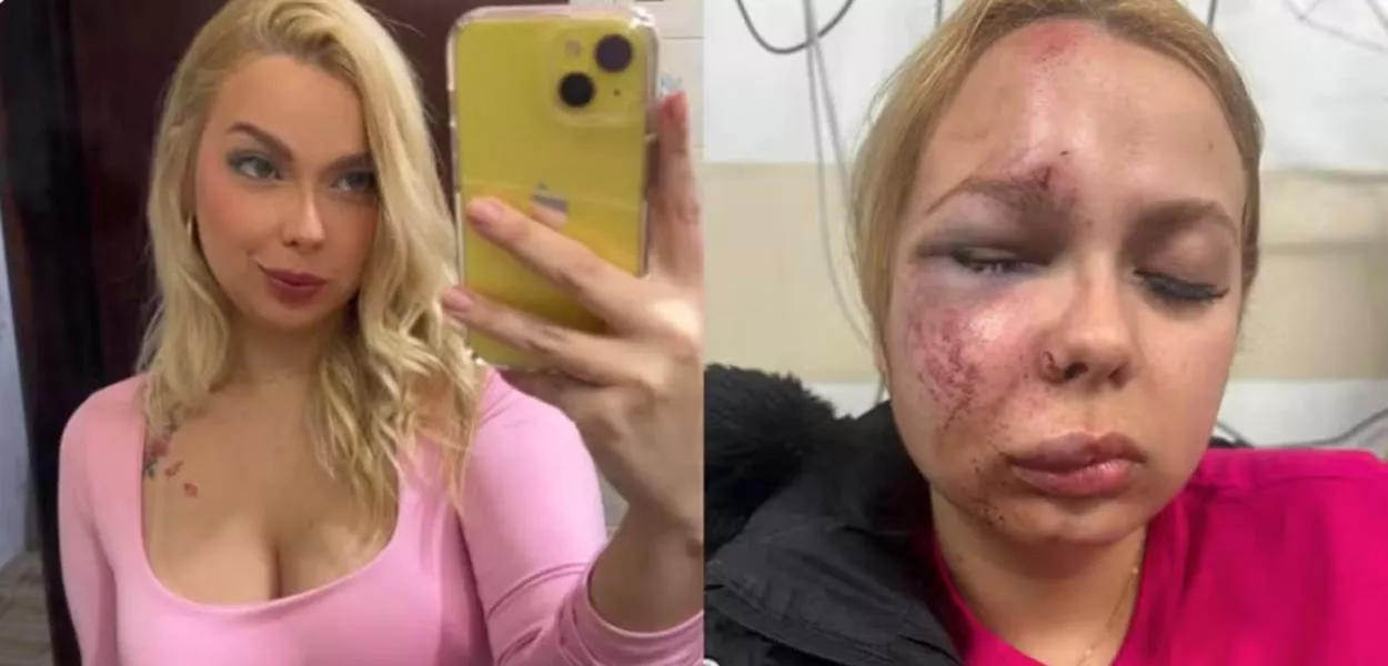Larissa afirma que o ataque não teve motivação patrimonial e nega que se tratasse de um assalto. Para ela, a violência teve características de tentativa de feminicídio